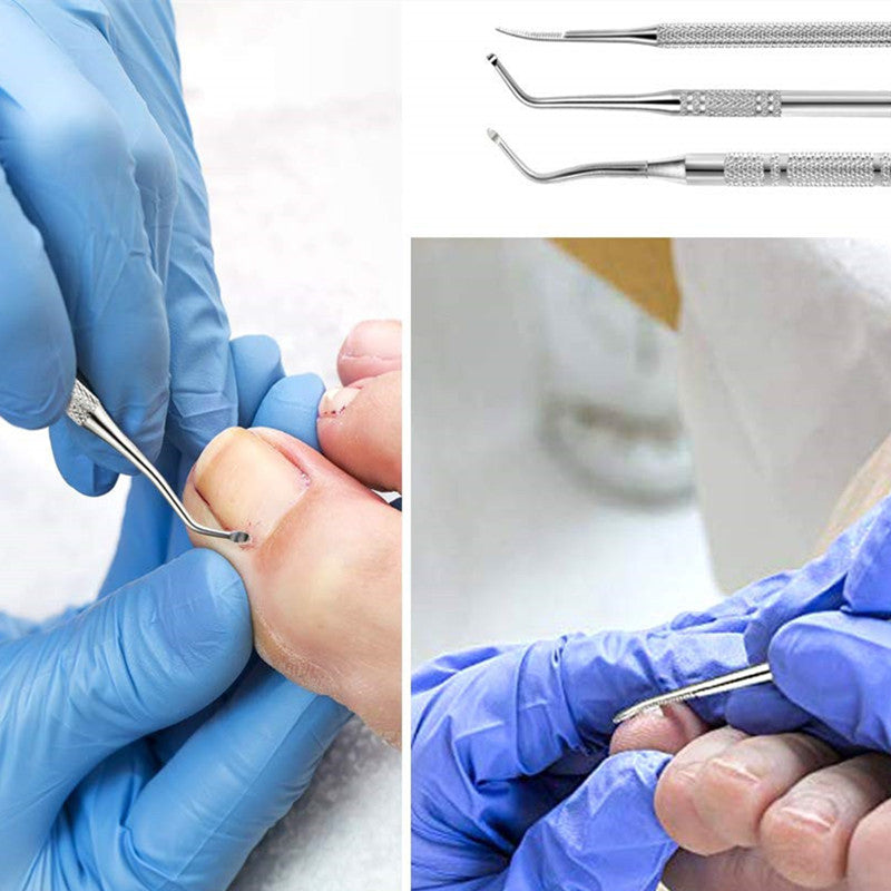 3pcs Stainless Steel Ingrown Pain Relief Toenail Tool Pedicure Tool Kit